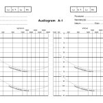 Audiogram A1 Within Blank Audiogram Template Download